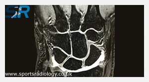 Arthrograms