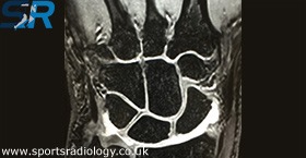 Arthrograms