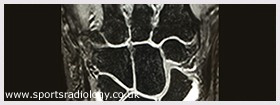 Arthrograms