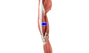 Iliotibial Band Syndrome