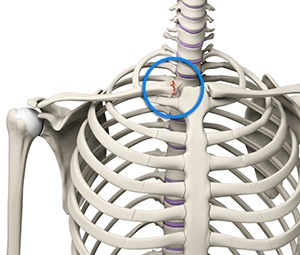 Sternoclavicular Injuries